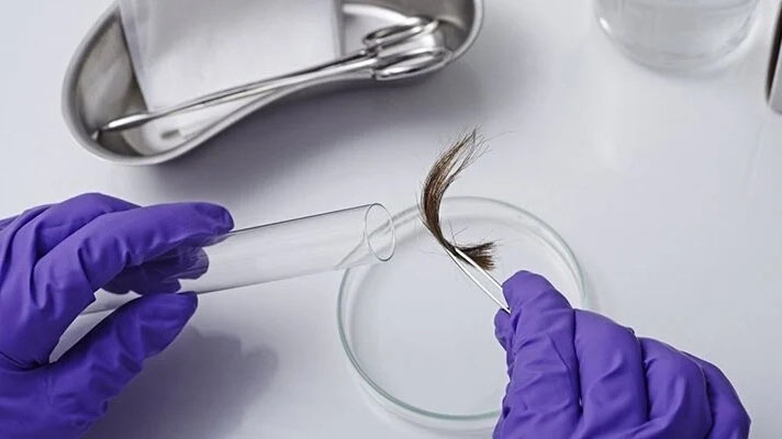 Xét nghiệm ADN là phân tích các mẫu ADN của các cá nhân để tìm ra dữ liệu di truyền của mỗi người. (Ảnh minh hoạ)