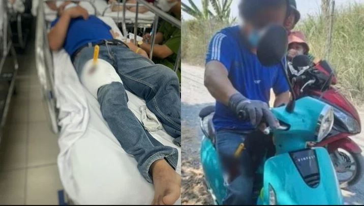 Tài xế công nghệ tự đâm dao vào đùi rồi hoang báo bị cướp.