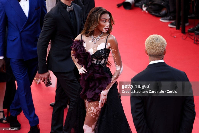 Tại Liên hoan phim Cannes ngày thứ 9, siêu mẫu bạch biến Winnie Harlow diện trang phục Zuhair Murad Couture tại buổi ra mắt phim The Count of Monte Cristo. Bộ trang phục có vẻ được lấy cảm hứng từ nội y, với chiếc áo nịt ngực được che một phần bởi chi tiết bông hoa khổng lồ.