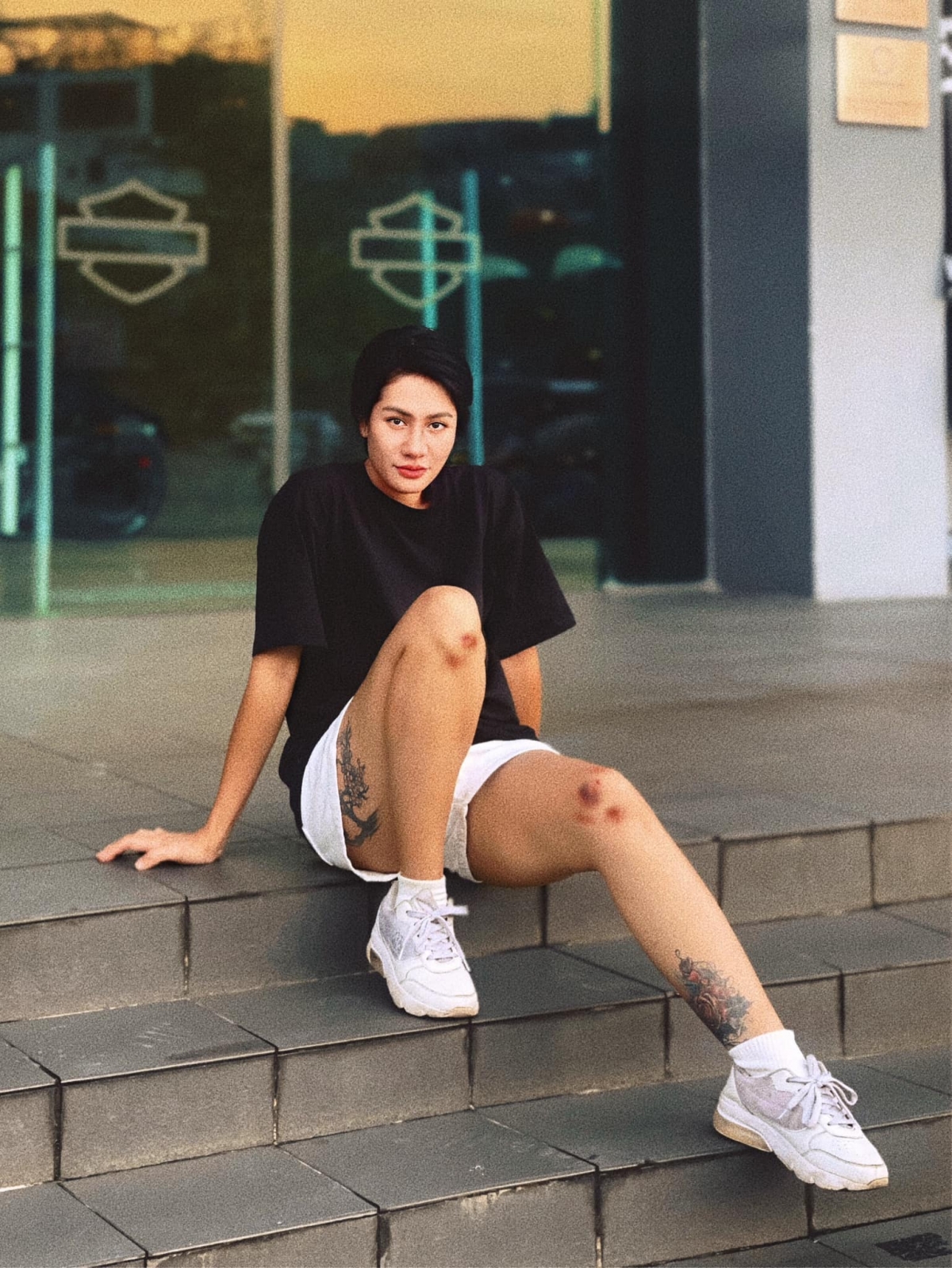 “Dăm ba cái vết trầy bầm”, diễn viên Minh Cúc bị xước xát ở đầu gối do ngã xe. (Nguồn: FBNV)