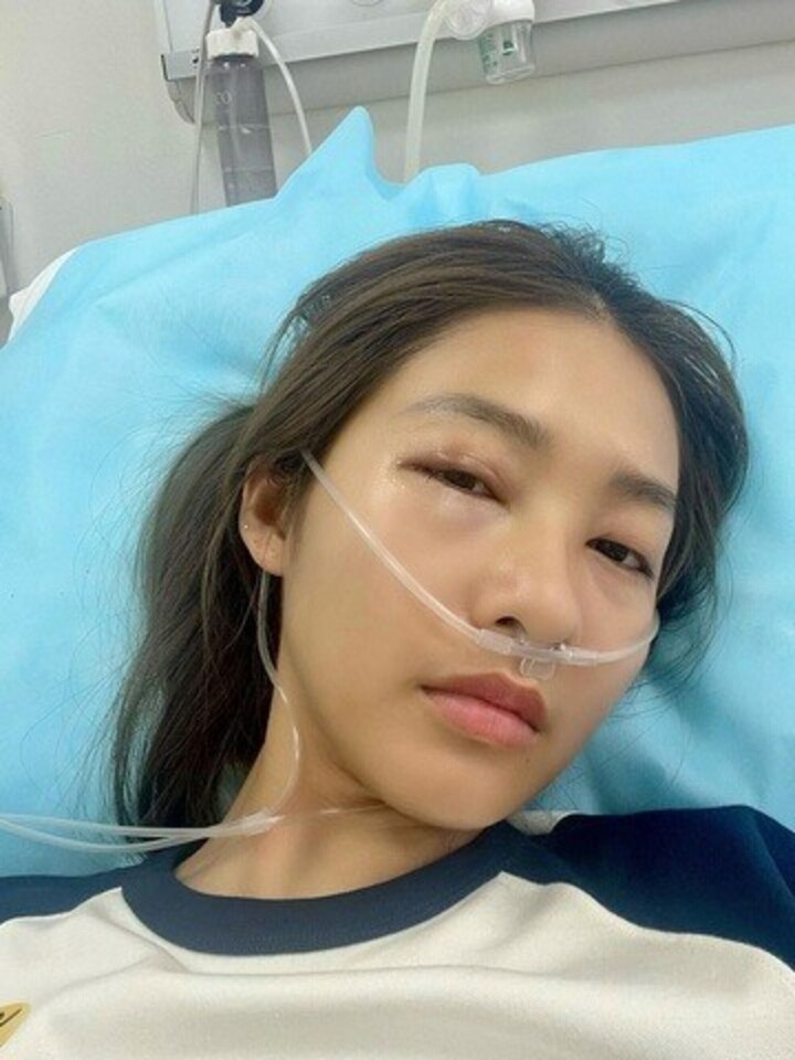 Khả Ngân chia sẻ bức ảnh cô nằm trên giường bệnh trong tình trạng đôi mắt sưng phù. Nữ diễn viên cho biết cô nhập viện trong tình trạng bị dị ứng thuốc chống phù nề sau chấn thương. Hiện sức khoẻ của cô đã ổn và tiếp tục điều trị. (Nguồn: FBNV)