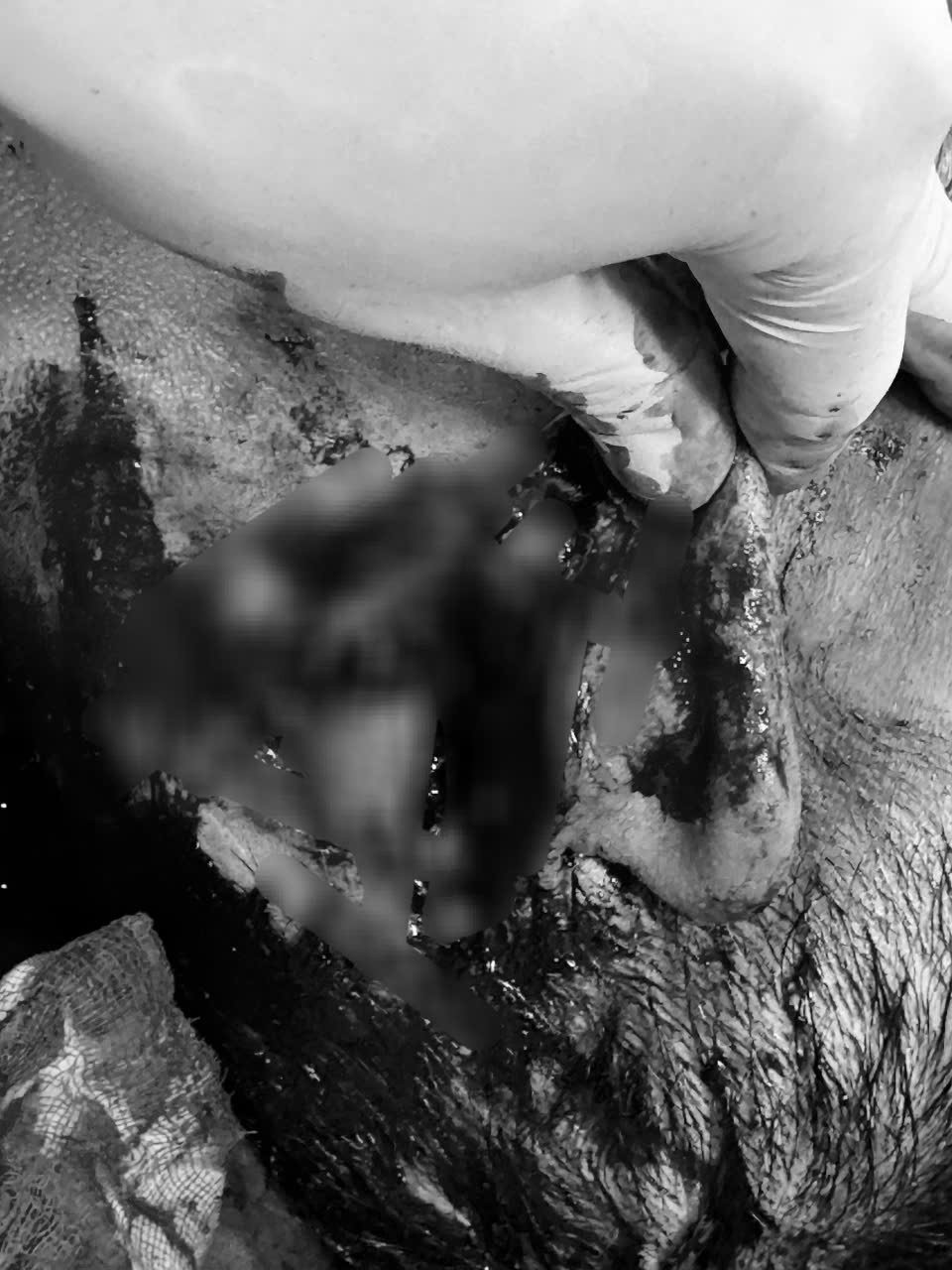 Phía sau đầu của nạn nhân bị thương tích rất nặng