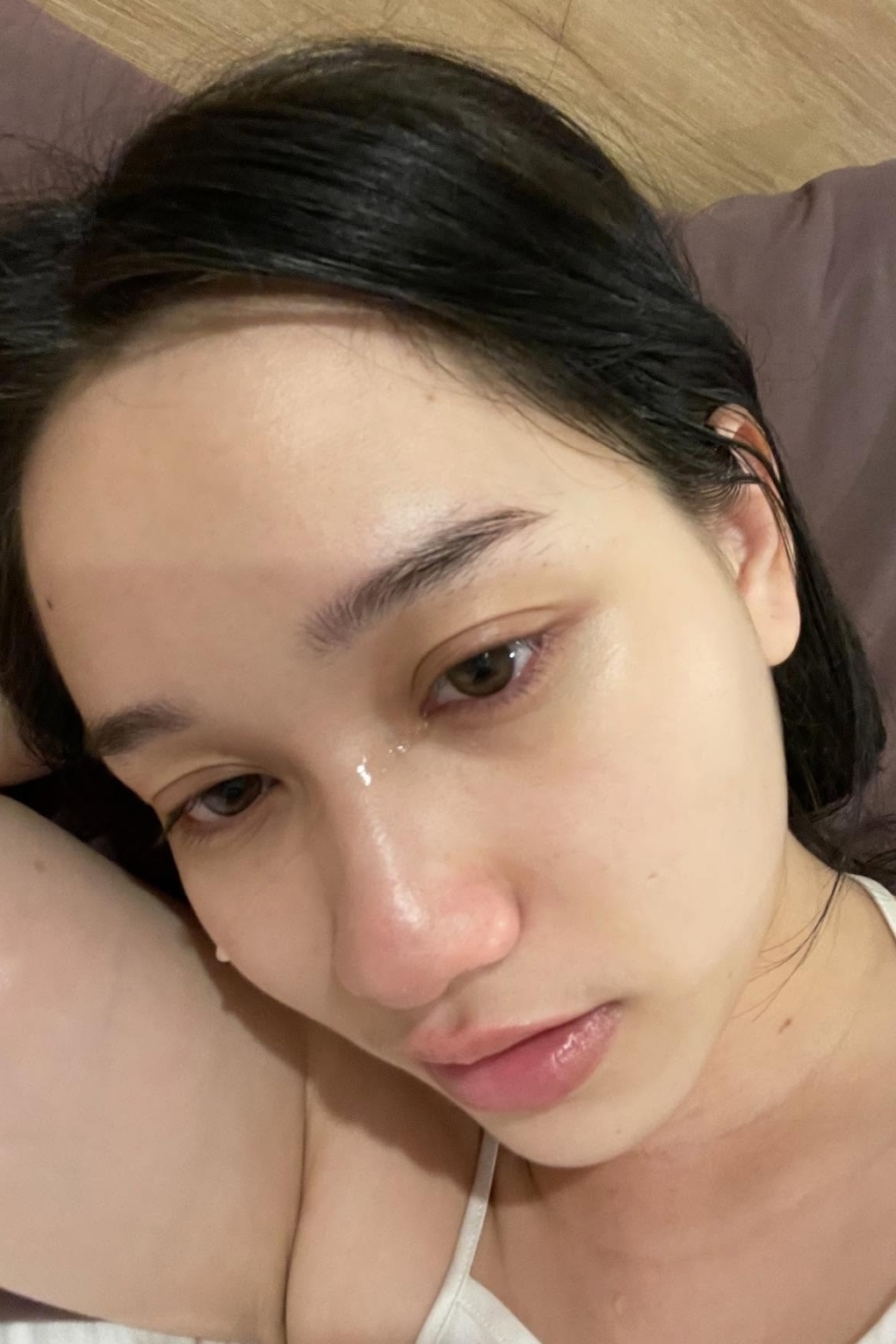 Sao Việt 4/3: Diễn viên Trúc Anh hé lộ hình ảnh rụng tóc, rạn da do bị tăng cân đột ngột, đang điều trị rối loạn cảm xúc và cho biết hành trình này nhiều gian nan.