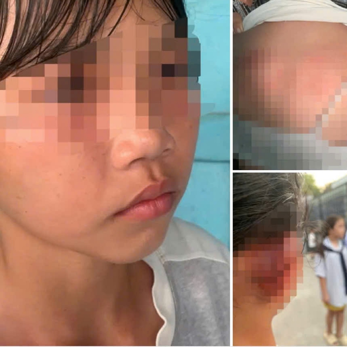 Hình ảnh học sinh bị bạn đánh (ảnh: mạng xã hội)