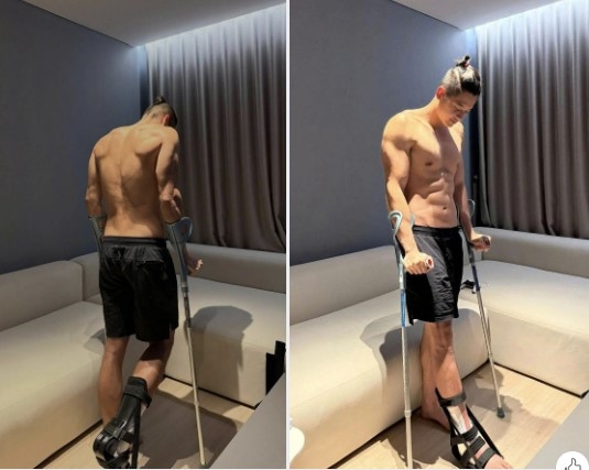 TikToker Trí Thịt Bòa (tên thật là Trí Phan sở hữu hơn 2,1 triệu người theo dõi) vừa trải qua một chấn thương nghiêm trọng sau 4 tiếng chơi pickleball