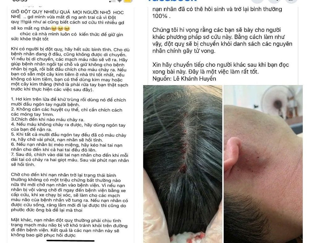 Phương pháp chữa đột quỵ bằng kim chích đầu ngón tay và dái tai lan truyền trên mạng xã hội (ảnh chụp màn hình)