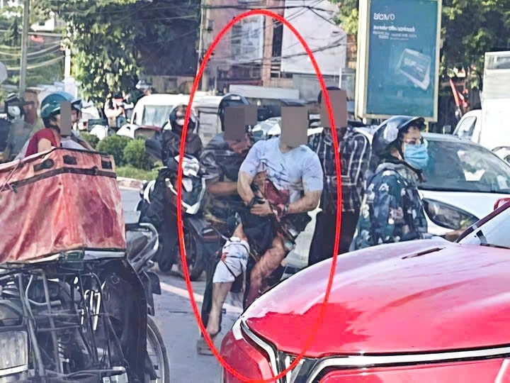 Hình ảnh nạn nhân bị chém gần đứt lìa một bàn tay.