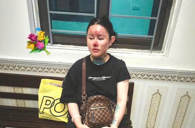 Đối tượng Nguyễn Thị Hoàng Ngân. Ảnh: CACC