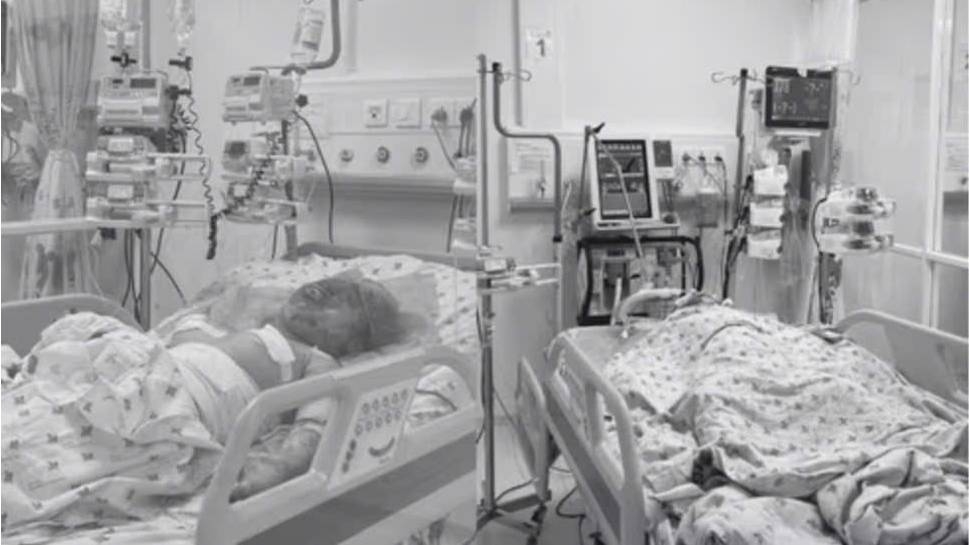 Hai cháu bé bị bỏng nặng, nguy kịch (ảnh T.C)