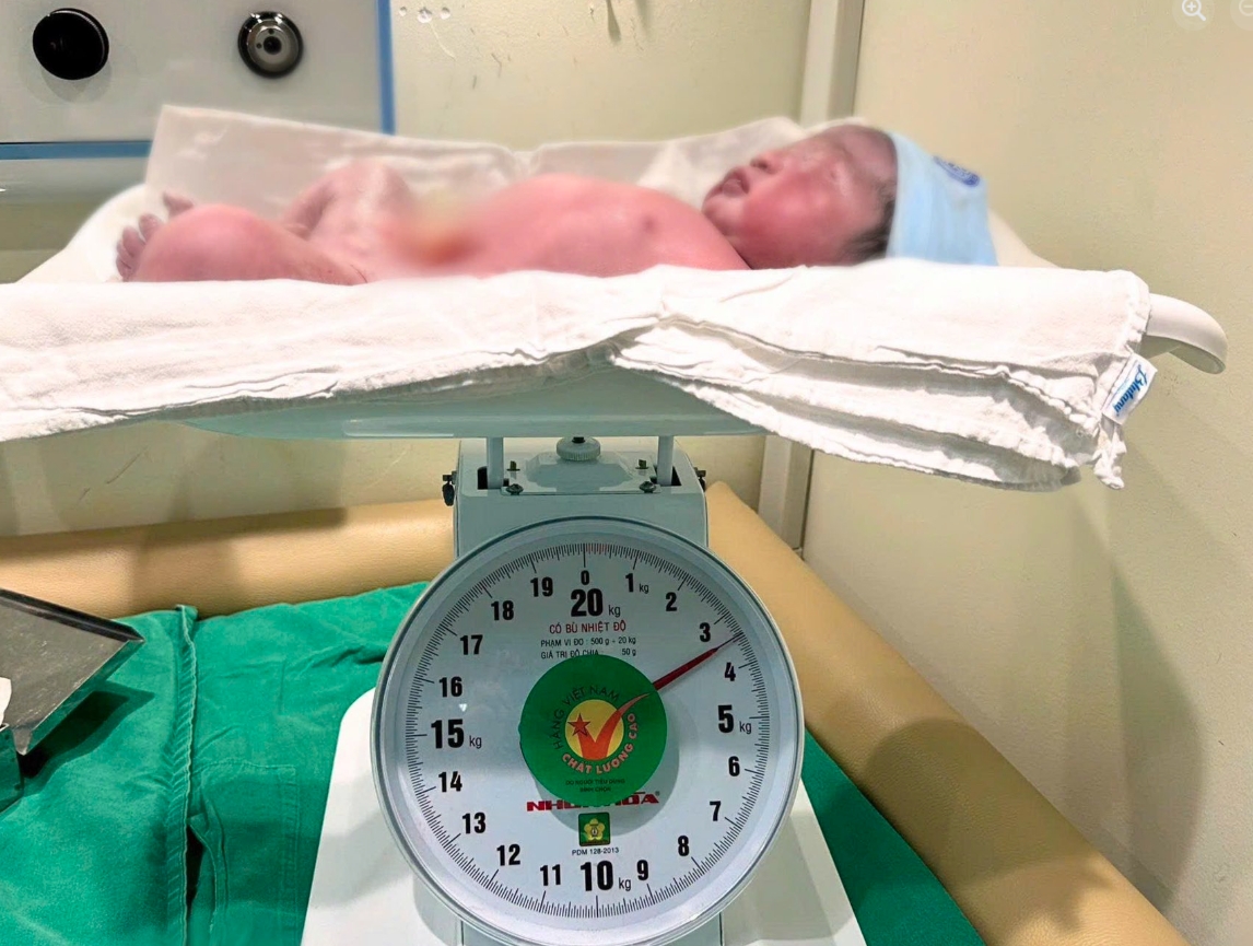 Bé trai nặng 3,4 kg hồng hào, khóc to. Ảnh: BV