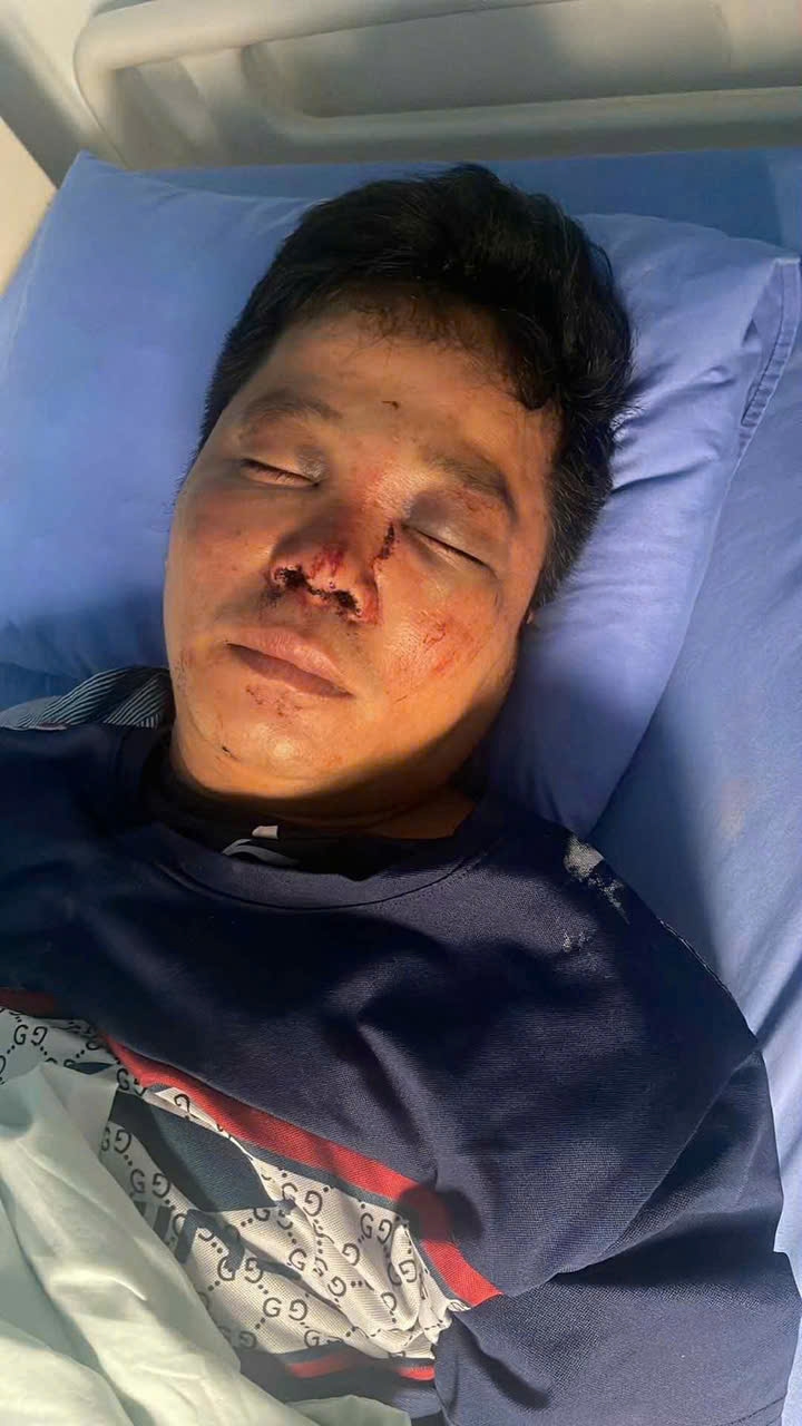 Hình ảnh anh Trung nhập viện sau khi bị hành hung