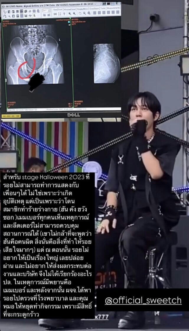 Roy của Plan B đã công khai cáo buộc Han (nay là Wangseok) hành hung anh