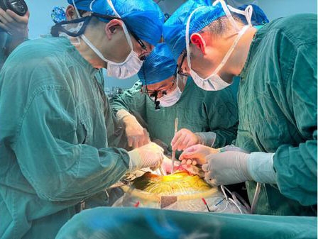 Các bác sĩ phẫu thuật ghép gan lợn chỉnh sửa gien cho bệnh nhân nam 71 tuổi vào ngày 17/5/2024. Ảnh tư liệu của Bệnh viện số 1 trực thuộc Đại học Y An Huy