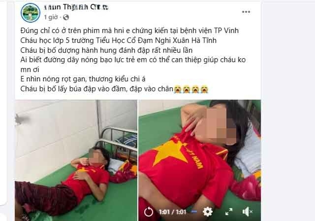 Cháu cháu H.T.N.L. bị hành hung phải nhập viện.