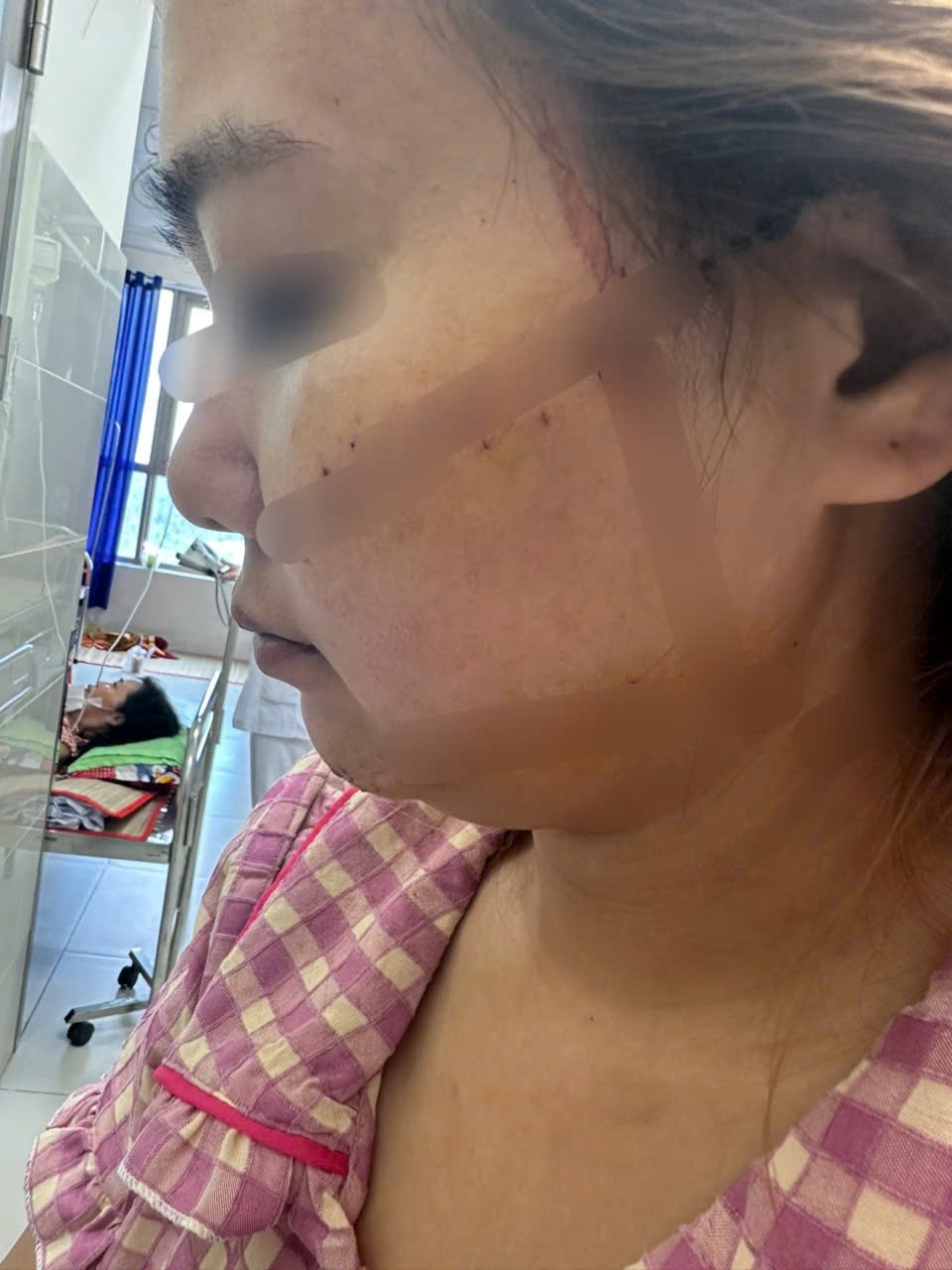 Nạn nhân trong vụ đánh ghen gây thương tích