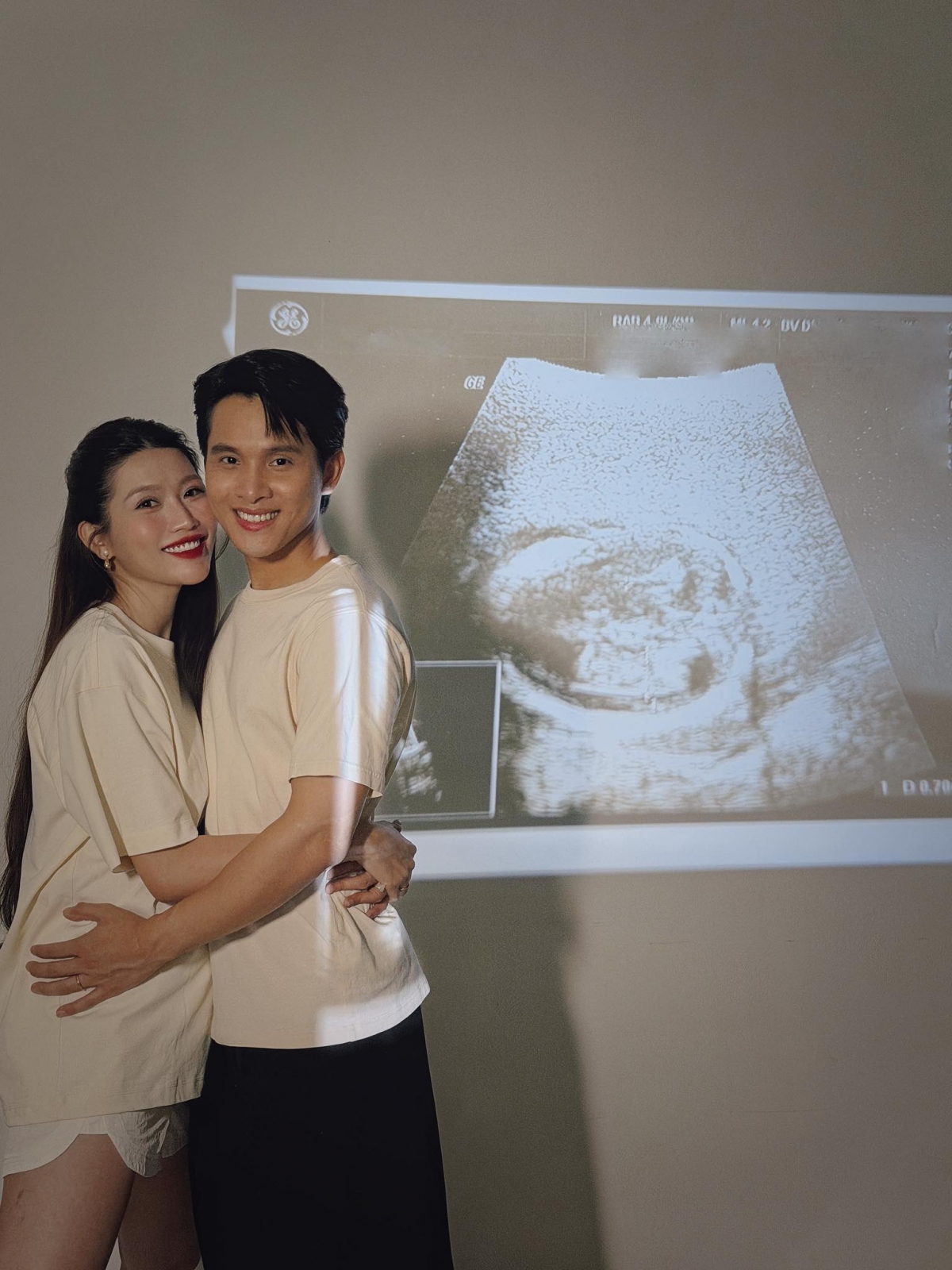 Á hậu Quỳnh Châu thông báo mang thai con đầu lòng. "Một phép màu nhỏ đang lớn lên mỗi ngày trong chúng mình. Lần đầu Châu và Phát trở thành ba mẹ… vừa hồi hộp, vừa hạnh phúc", cô chia sẻ.