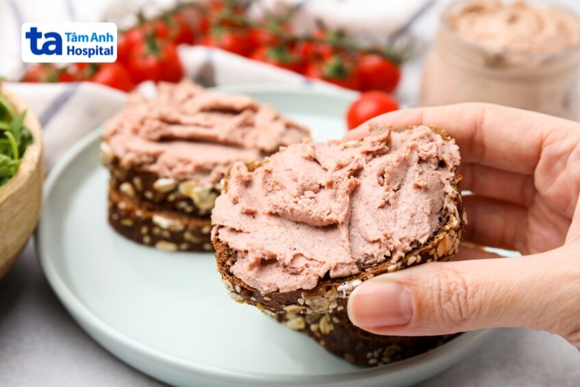 Pate là món ăn quen thuộc, giàu đạm và chất béo, nhưng cũng tiềm ẩn nguy cơ ngộ độc thực phẩm nếu nguyên liệu không bảo đảm