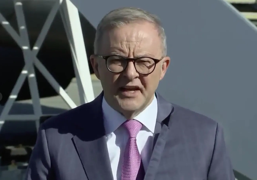 Thủ tướng Australia Anthony Albanese. Ảnh: AP
