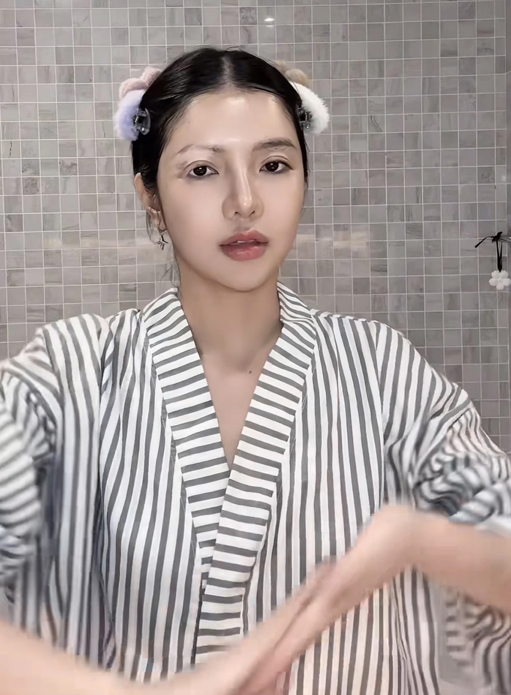 CiiN thẳng thắn xác nhận mình mắc bệnh bạch biến, một dạng bệnh da liễu hiếm gặp, chỉ xuất hiện ở khoảng 2% dân số trên thế giới.