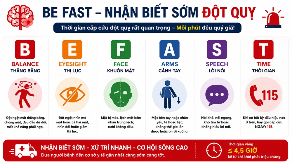 Giờ vàng cấp cứu đột quỵ là trong 3 - 4,5 giờ đầu tiên kể từ khi có triệu chứng