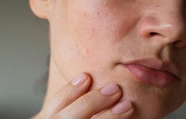 Ô nhiễm môi trường và thói quen sinh hoạt thiếu khoa học khiến da dễ xỉn màu, khô ráp và xuất hiện nám, tàn nhang