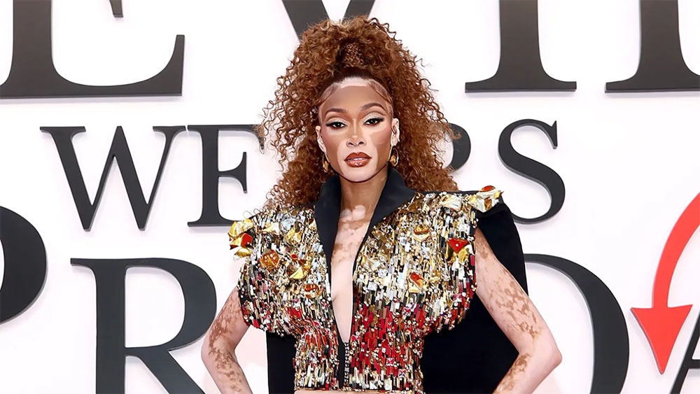 Winnie Harlow, người mẫu kiêm nhà hoạt động xã hội nổi lên sau khi tham gia chương trình America's Next Top Model đã có một màn xuất hiện khách mời đầy ý nghĩa trong đoạn phim tổng hợp của Tuần lễ thời trang Milan. (Ảnh: Getty Images)