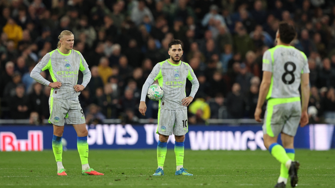 Man City bất ngờ vấp ngã trước Everton. (Ảnh: Reuters)