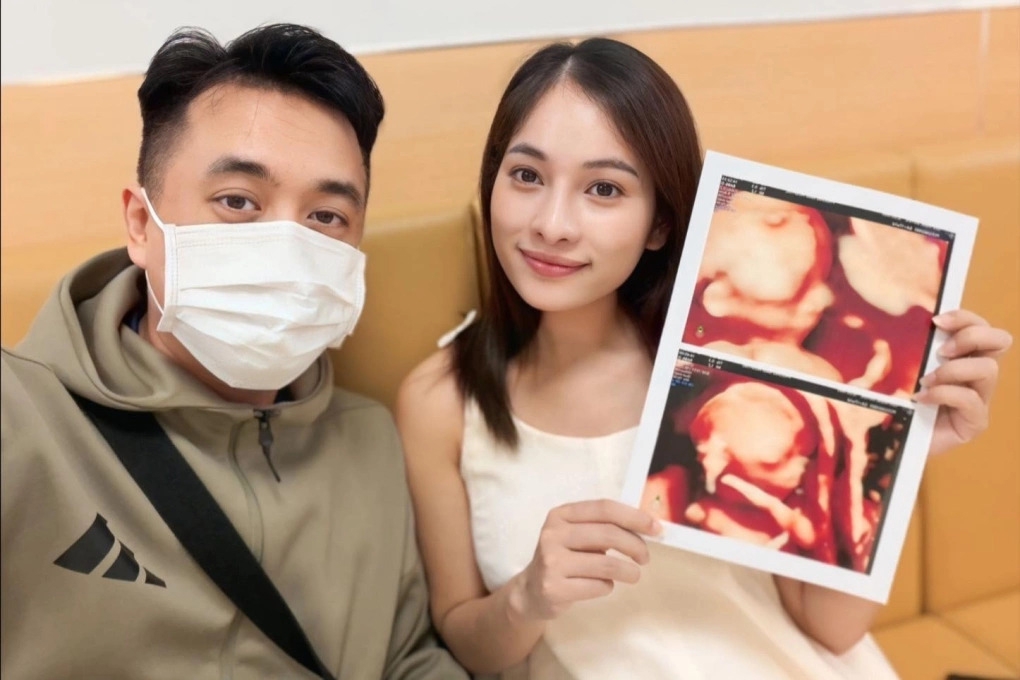 Nhạc sĩ Dương Khắc Linh bày tỏ cảm giác hồi hộp, chưa dám tin việc anh sắp có thêm hai “công chúa”, nâng tổng số con lên bốn.