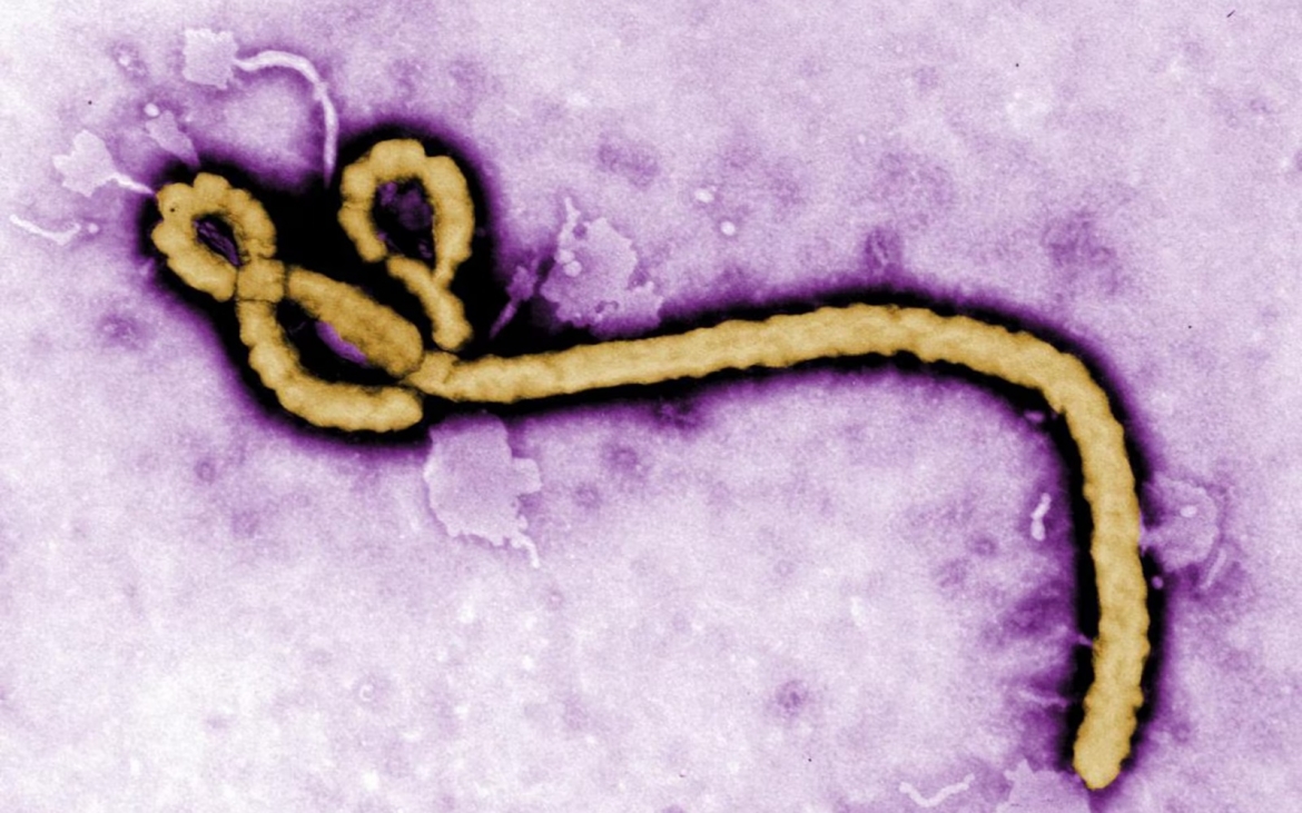 Virus Ebola. Ảnh: CDC/Reuters.