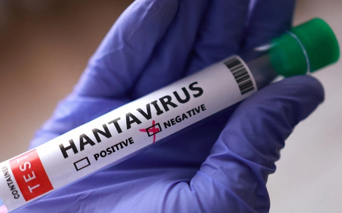 Ống xét nghiệm virus Hanta. Ảnh: Reuters.