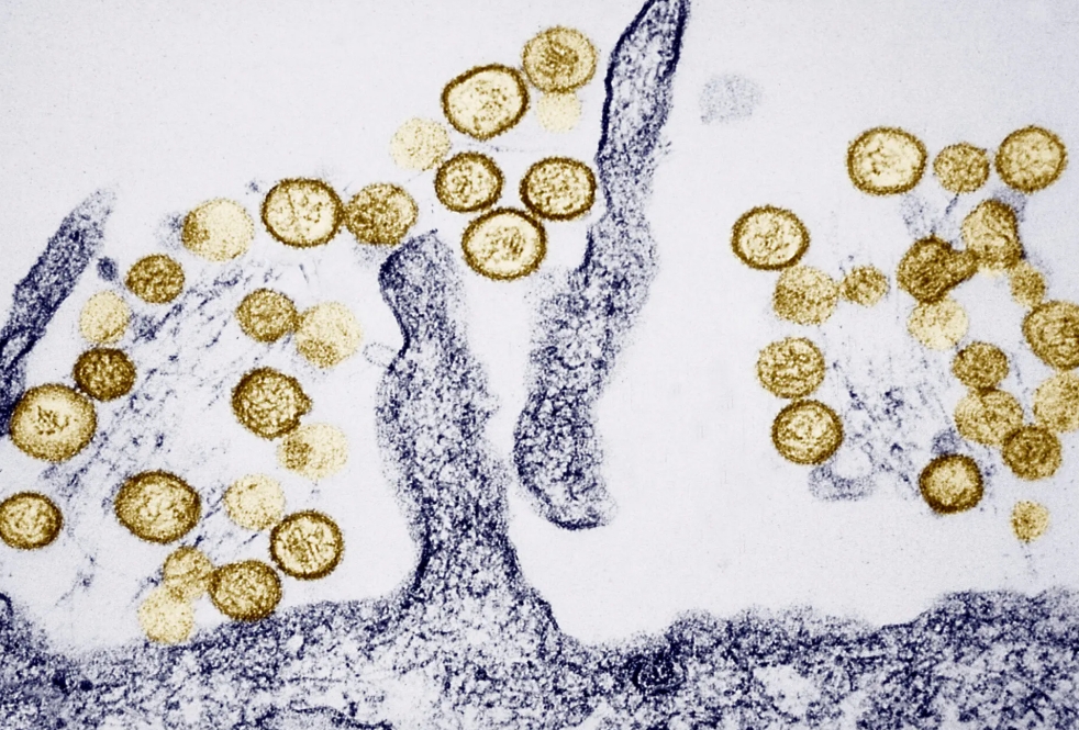 Virus Hanta thường lây lan qua phân khô của động vật gặm nhấm. Ảnh: BSIP