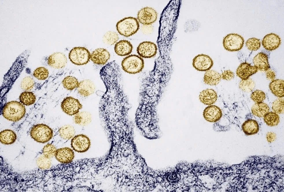 Virus Hanta thường lây lan qua phân khô của động vật gặm nhấm. (Ảnh: BSIP)