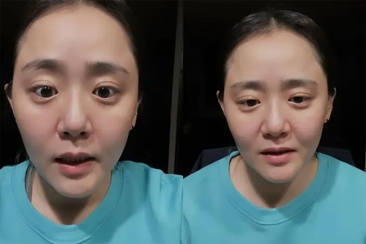 Vào thời điểm đỉnh cao sự nghiệp diễn xuất, Moon Geun-young đã phải trải qua khủng hoảng sức khỏe nghiêm trọng. (Ảnh: Sohu)