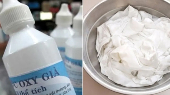 Đối với những vết ố vàng tồn tại lâu ngày, oxy già là lựa chọn đáng cân nhắc. (Ảnh minh họa)